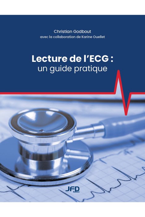 Lecture de l’ECG : un guide pratique