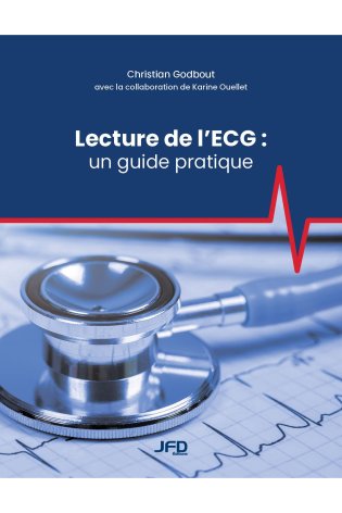 Lecture de l’ECG : un guide pratique