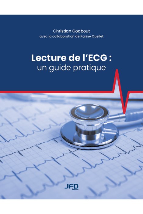 Lecture de l’ECG : un guide pratique